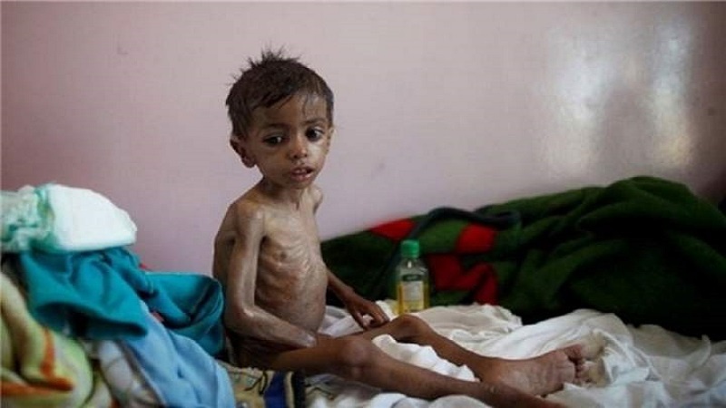 مرگ کودکان در یمن