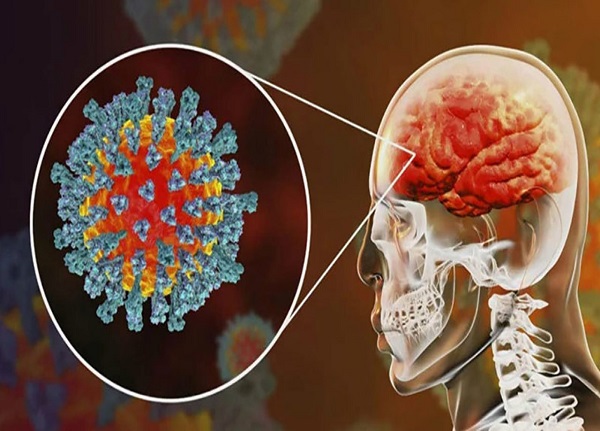 تاثیر ویروس کرونا بر مغز | کرونا مغز را ۱۰ سال پیرتر می‌کند + کاهش ضریب هوشی