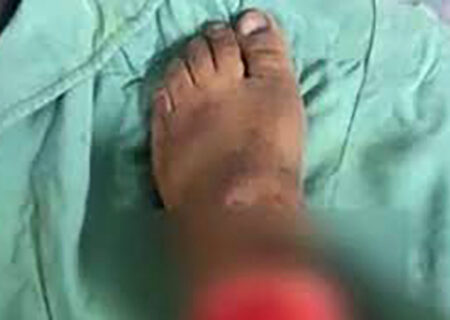 کشف پای قطع شده زن جوان در کهریزک تهران