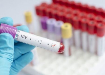 ۷۲ ساعت طلایی برای نابودی ویروس اچ آی وی