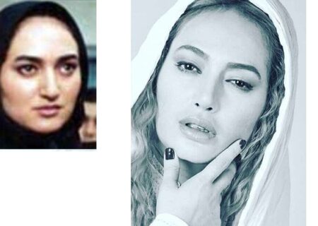 قبل و بعد عمل جراحی زیبایی بازیگران زن ایرانی + عکس