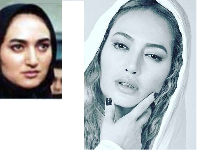 قبل و بعد عمل جراحی زیبایی بازیگران زن ایرانی + عکس