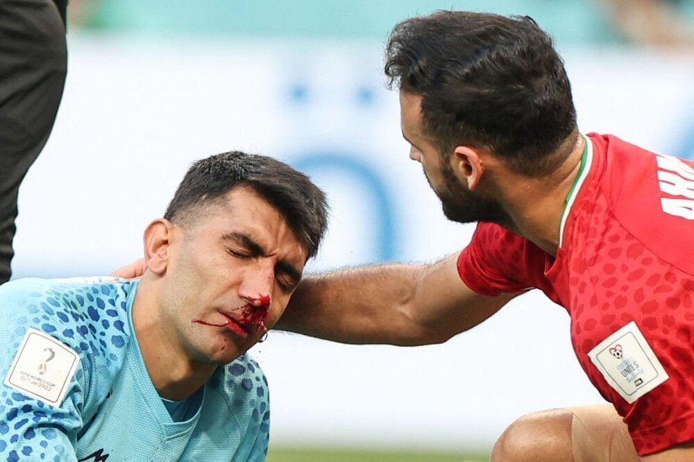 بیرانوند جام جهانی را از دست داد آسیب جدی تر از شکستگی بینی است/ واکنش محمدرضا خانزاده به هجمه‌ها علیه بیرانوند