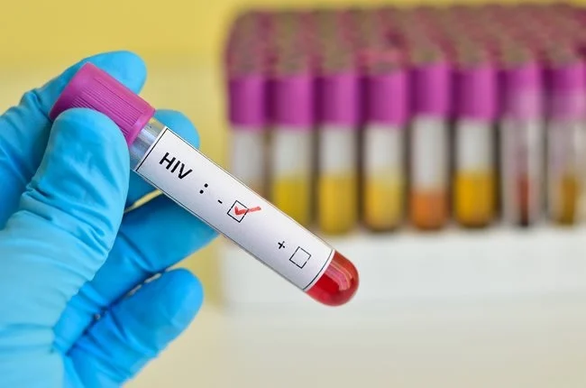 سومین فرد مبتلا به ایدز پس از پیوند سلول های بنیادی درمان شد
