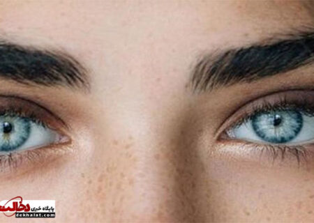 عوارض خطرناک جراحی زیبایی تغییر رنگ چشم