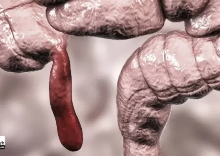 پژوهشگران از افزایش شیوع سرطانی نادر در جوانان خبر می‌دهند